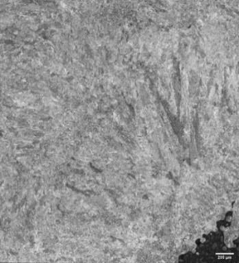 Image of 17-4 PH steel sample etched with Waterless Kalling's etchant, at 100x (10x objective)